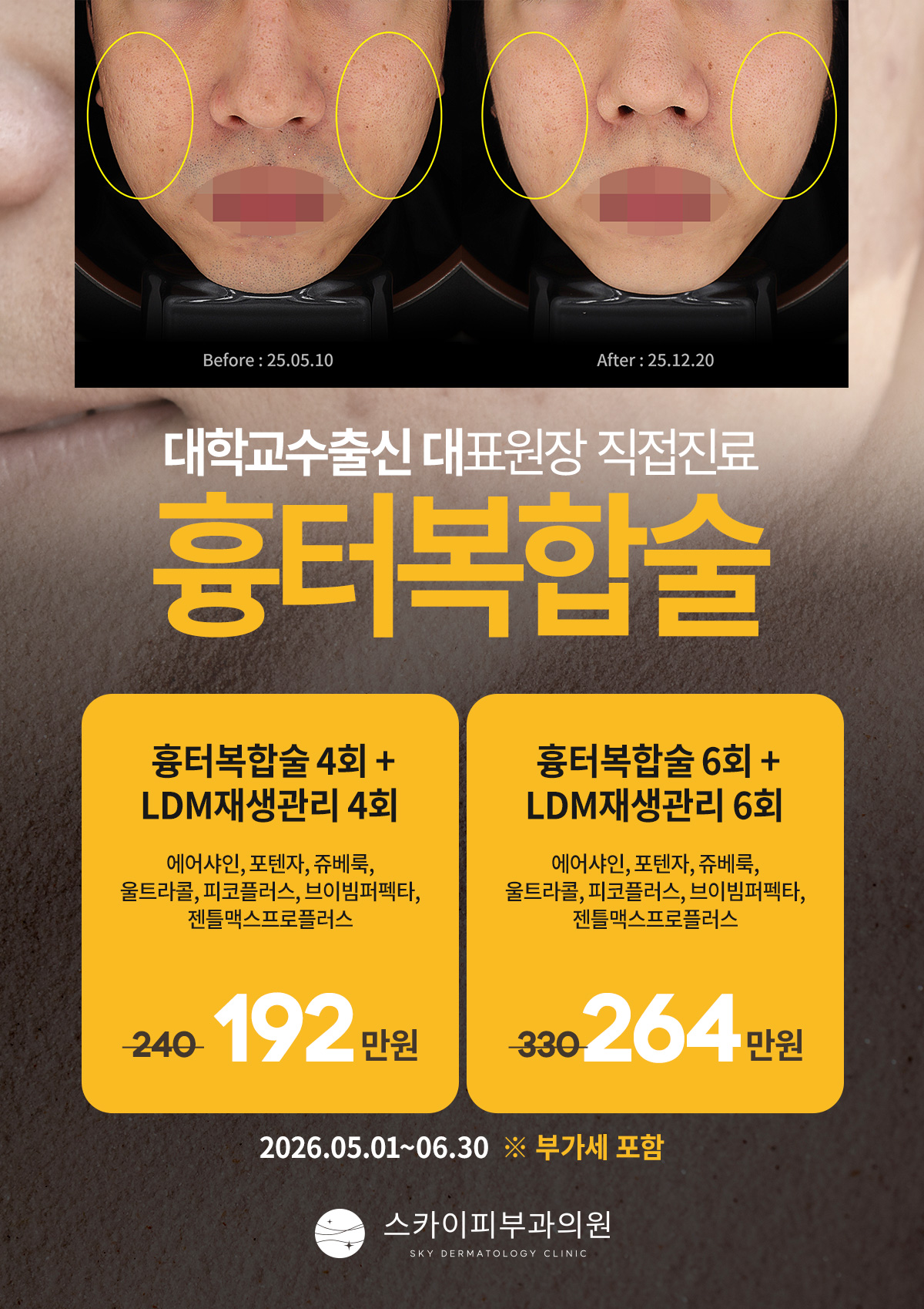 복합흉터술.jpg